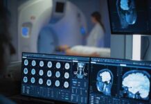 Brain Scans Predict Alzheimer’s Years Early