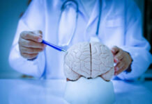 How Your Brain Sabotages Balance Over Time A doctor pointing at a brain model with a pen