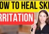 How To Heal And Prevent Skin Irritation