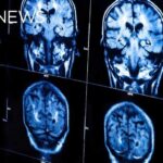 New guidelines urge doctors to treat heart and brain health