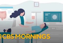 Breaking down the new colorectal cancer screening guidelines