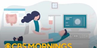 Breaking down the new colorectal cancer screening guidelines