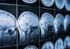 Daily Sweat, Younger Brain Scans Close-up of MRI brain scans displayed on a screen