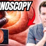 Doctor explains Colonoscopy | Prep, during and after - what you need to know