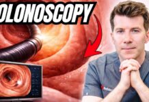 Doctor explains Colonoscopy | Prep, during and after - what you need to know