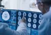 Brain Tipping Point That Triggers Sudden Forgetting Doctors reviewing brain MRI scans on multiple monitors