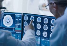 Brain Tipping Point That Triggers Sudden Forgetting Doctors reviewing brain MRI scans on multiple monitors