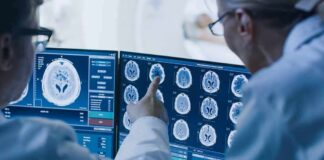 Doctors reviewing brain MRI scans on multiple monitors