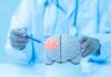 Inside Mayo’s Migraine Breakthrough—It’s Not Pills Doctor examining a model of a brain with a pen