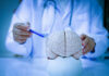 Brain Shrink Warning – When It Begins A doctor pointing at a brain model with a pen