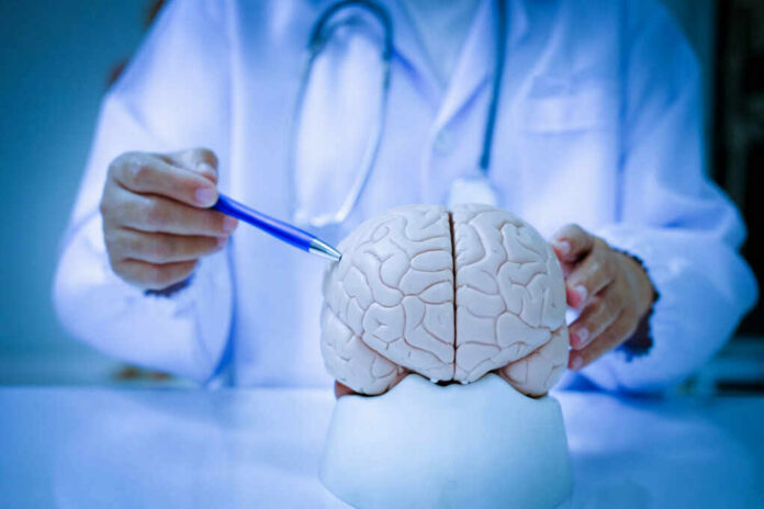 9a3727d6-ff70-4c52-bc15-2dd3fe515569_shutterstock2285140051jpg A doctor pointing at a brain model with a pen