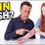 Skin Rash: What Your Body Is Trying to Tell You Before It Gets Worse | Causes, Symptoms & Treatment