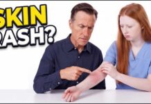 Skin Rash: What Your Body Is Trying to Tell You Before It Gets Worse | Causes, Symptoms & Treatment