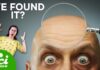 Can Men’s Baldness Be Reversed? Can Baldness Be Reversed?