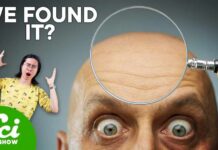 Can Baldness Be Reversed?