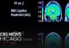 Expert emphasizes how lifestyle and metabolism affect brain health