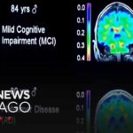 Expert emphasizes how lifestyle and metabolism affect brain health