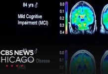 Expert emphasizes how lifestyle and metabolism affect brain health