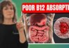 6 Hidden Blockers of Vitamin B12 Absorption Gut, Genes & Medications Explained