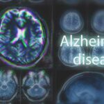 Brain MRI scans with highlighted section and text overlay