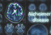 Harvard’s Lithium Twist Shocks Alzheimer’s Playbook Brain MRI scans with highlighted section and text overlay