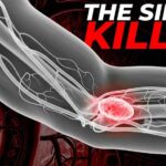 The Silent Warning Signs of Blood Clots