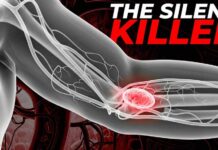 Silent blood clots, and how they turn deadly The Silent Warning Signs of Blood Clots