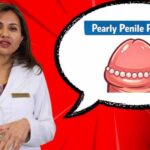 Pearly Penile Papules Explained | Harmless or STD? The Truth You Need to Know