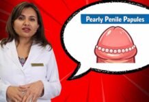 Penile Health: A Urologist’s Guide to Noncancerous Bumps, Lumps, and Spots Pearly Penile Papules Explained | Harmless or STD? The Truth You Need to Know