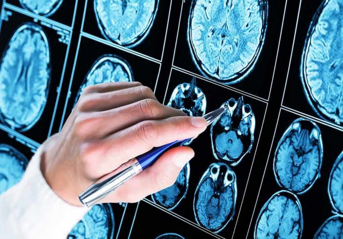 Hand with pen pointing at brain MRI scans